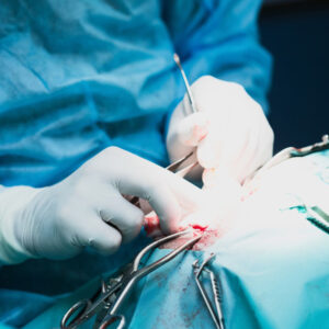 Gastrointestinal Surgery: Preparation and Post Op Care