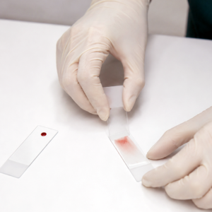 How to Make a Blood Smear