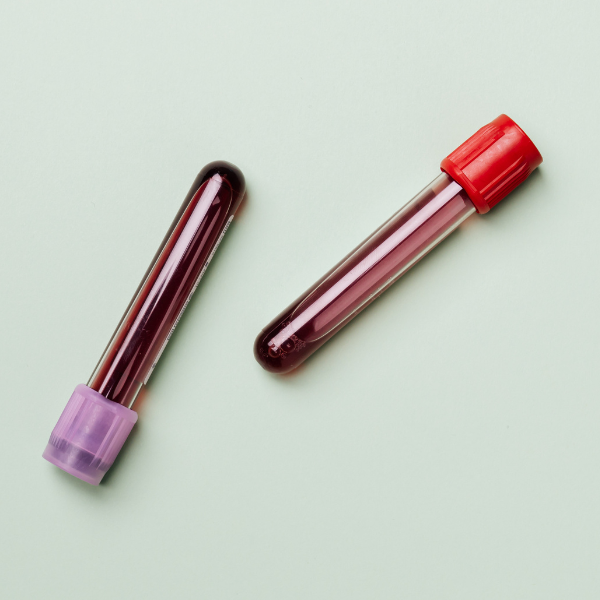 Understanding Biochemistry Tests