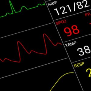 Understanding Your Monitoring Gadgets