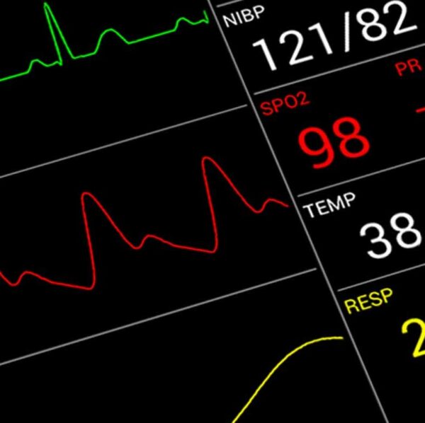 Understanding Your Monitoring Gadgets