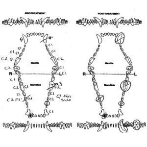 Dental Charting