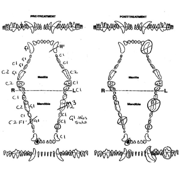 Dental Charting