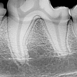 Dental Radiography