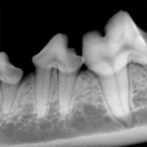 Intra-Oral Radiography